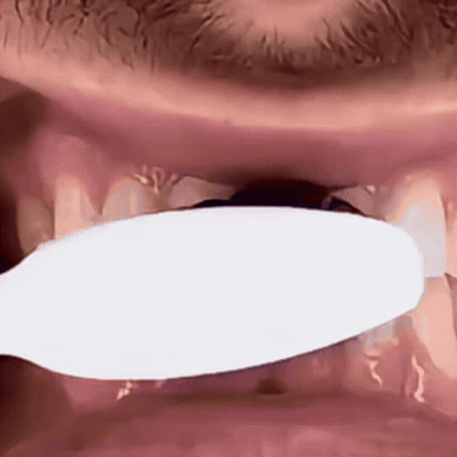 GlowDent – Fogfehérítő fogkrém