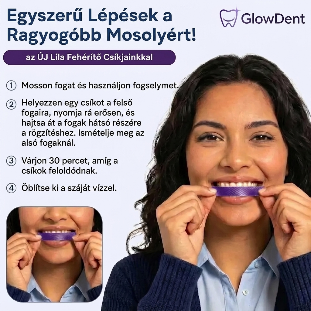 GlowDent – Lila Fogfehérítő Csíkok (7 csíkos szett)